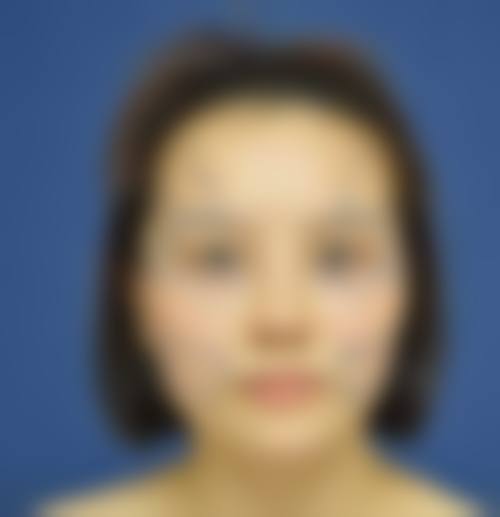 三、北京太平洋专精整形诊所诊疗项目有哪些？