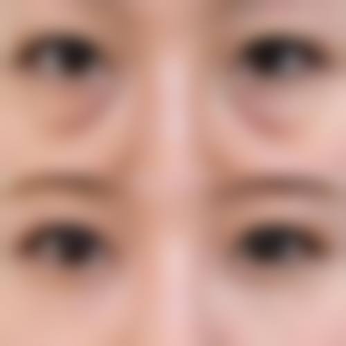 九、四川广元医而美美华整形门诊部真实的患者评价