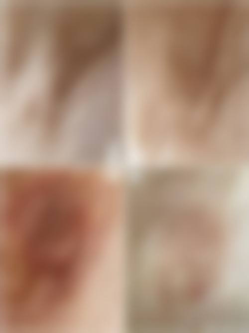 四、昆明西山区典雅阁医疗美容整形医院特色项目