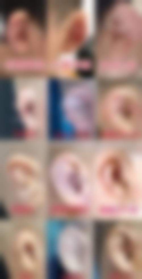 五、深圳睦心盛放整形医院价格表