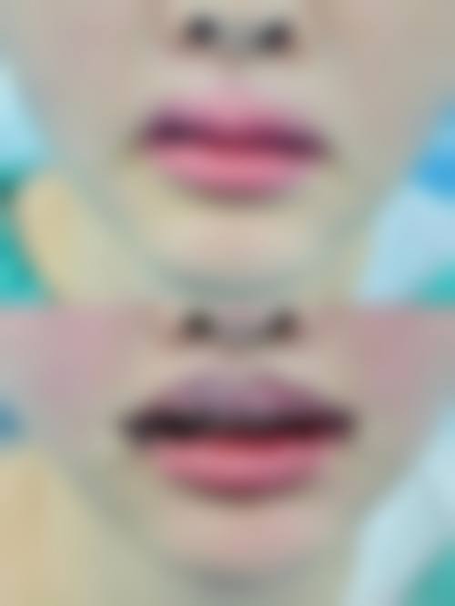 八、北京太平洋专精整形诊所真实的患者评价