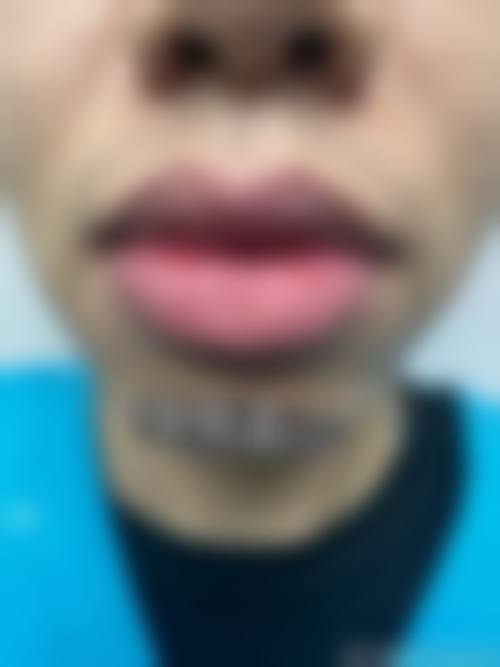 二、昆明盘龙华连众美医疗美容医院怎么样？