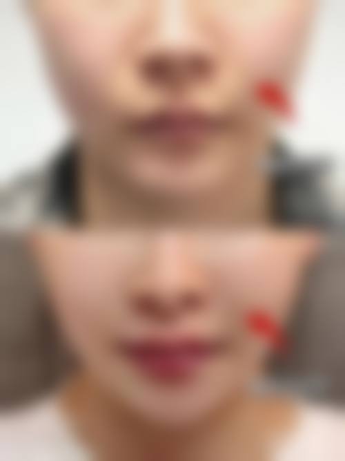 八、上海美丽之星医疗美容医院预约方式