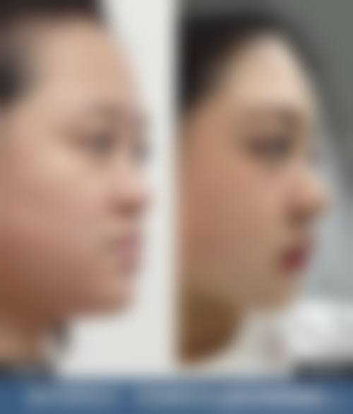 一、深圳健丽医疗美容医院正规吗？