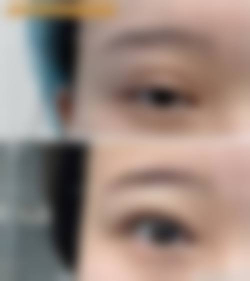 八、大同美珠美际医疗美容诊所真实的患者评价