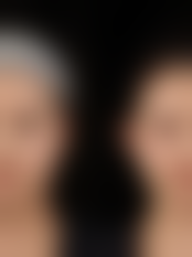 什么东西对眼袋好？日常护理、护肤品、医美手段及饮食调理全攻略来了！ 