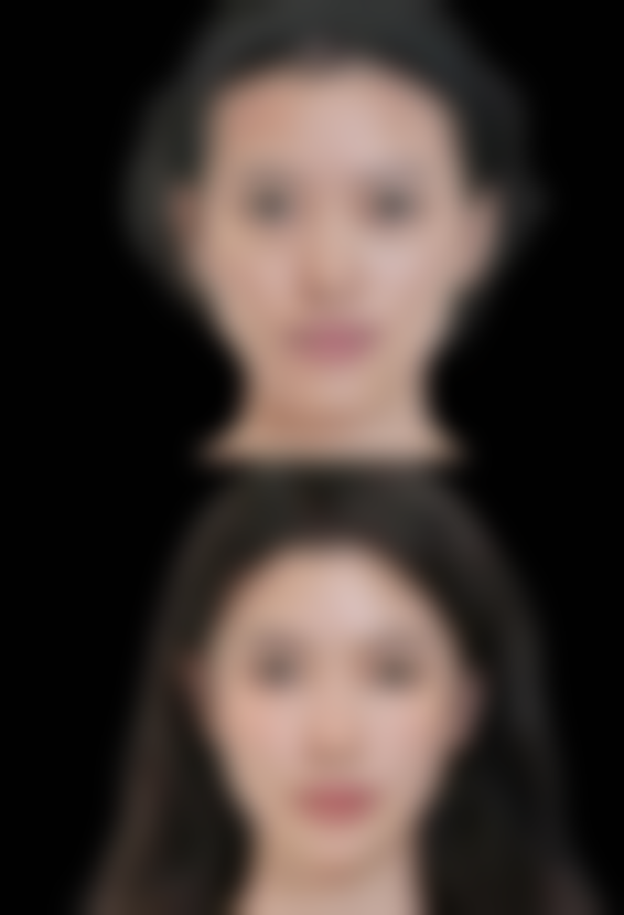 隆鼻鼻子麻木多久消失正常？影响恢复时间的因素及应对方法揭秘