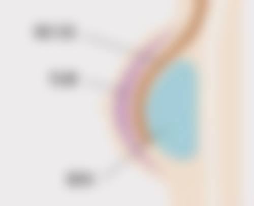 五、不同人群的用药选择