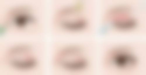 隆胸假体多久要更换一次？影响因素、检查频率及更换情况全揭秘 