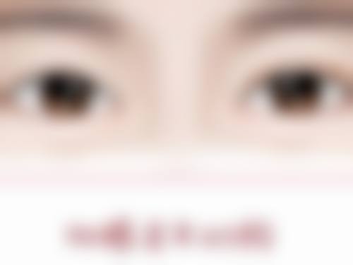 四、其他改善方法