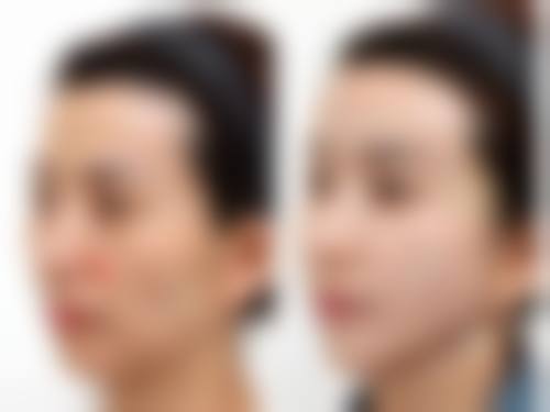 七、汕头圣博医疗美容门诊部预约方式