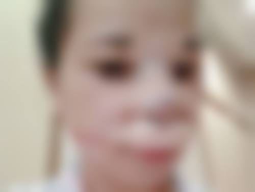 隆胸材料哪种比较好一点？硅胶、自体脂肪等各有优劣，选择适合的才是关键！ 