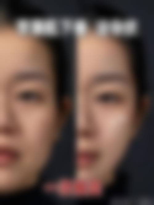 九、北京薇依医疗美容门诊部真实的患者评价