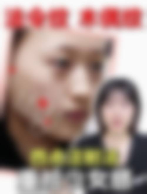 四、瑞安靳海涛整形医院特色项目