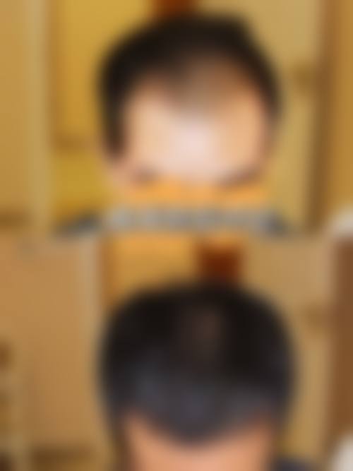 八、云南昆明春草世纪植发医院预约方式