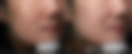 三、湖州芊喜医疗美容诊所诊疗项目有哪些？