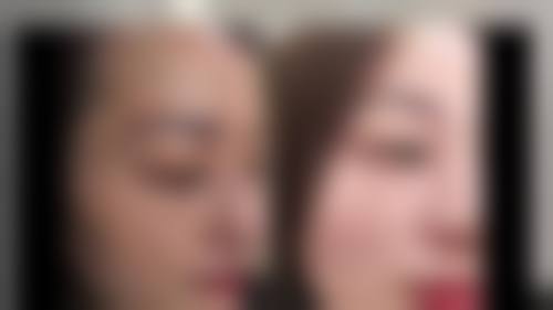 二、郑州科大医院私密整形科怎么样？