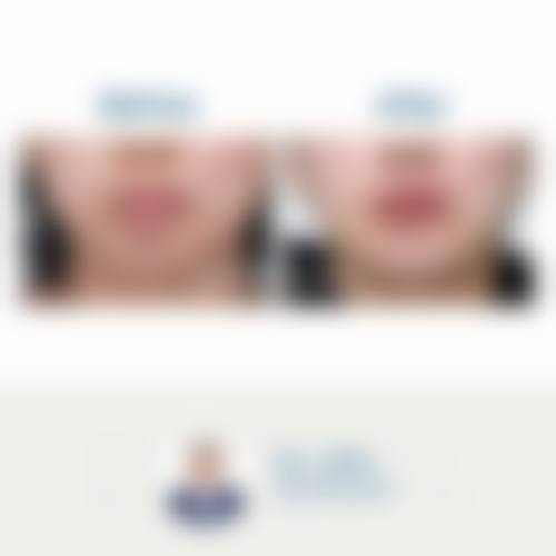 六、宁波鄞州花历整形医院价格表