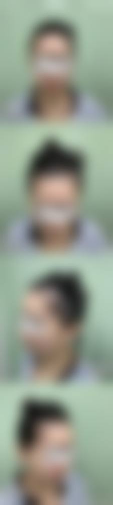 九、宁波鄞州花历整形医院真实的患者评价