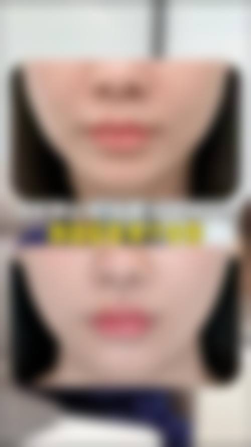 六、哈尔滨悠然国内外医疗整形医院价格表