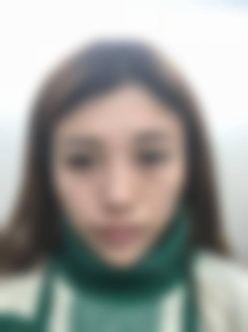 二、云南昆明春草世纪植发医院怎么样?