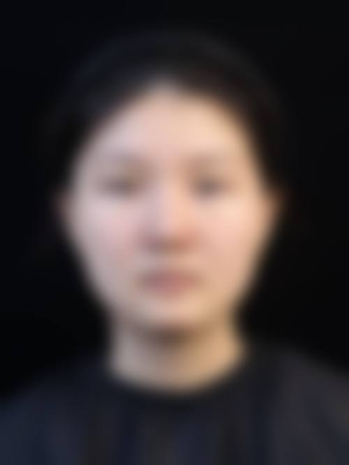 二、成都忠爱整形美容医院怎么样？