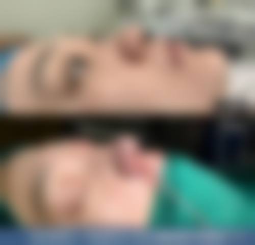 三、郑州科大医院私密整形科诊疗项目有哪些？