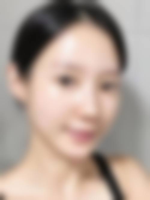 五、汕头圣博医疗美容门诊部价格表