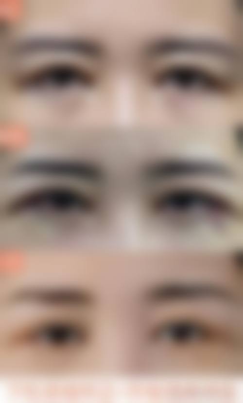 三、日本百人町阿尔法整形诊所诊疗项目有哪些？