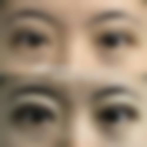 九、云南昆明春草世纪植发医院真实的患者评价