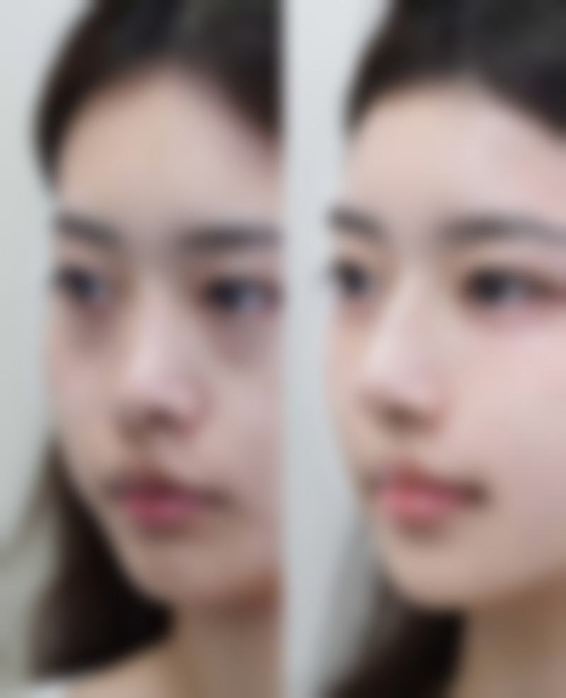 四、运城雅都美容整形门诊部特色项目