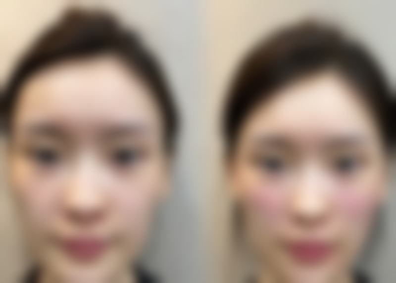 九、运城雅都美容整形门诊部真实的患者评价