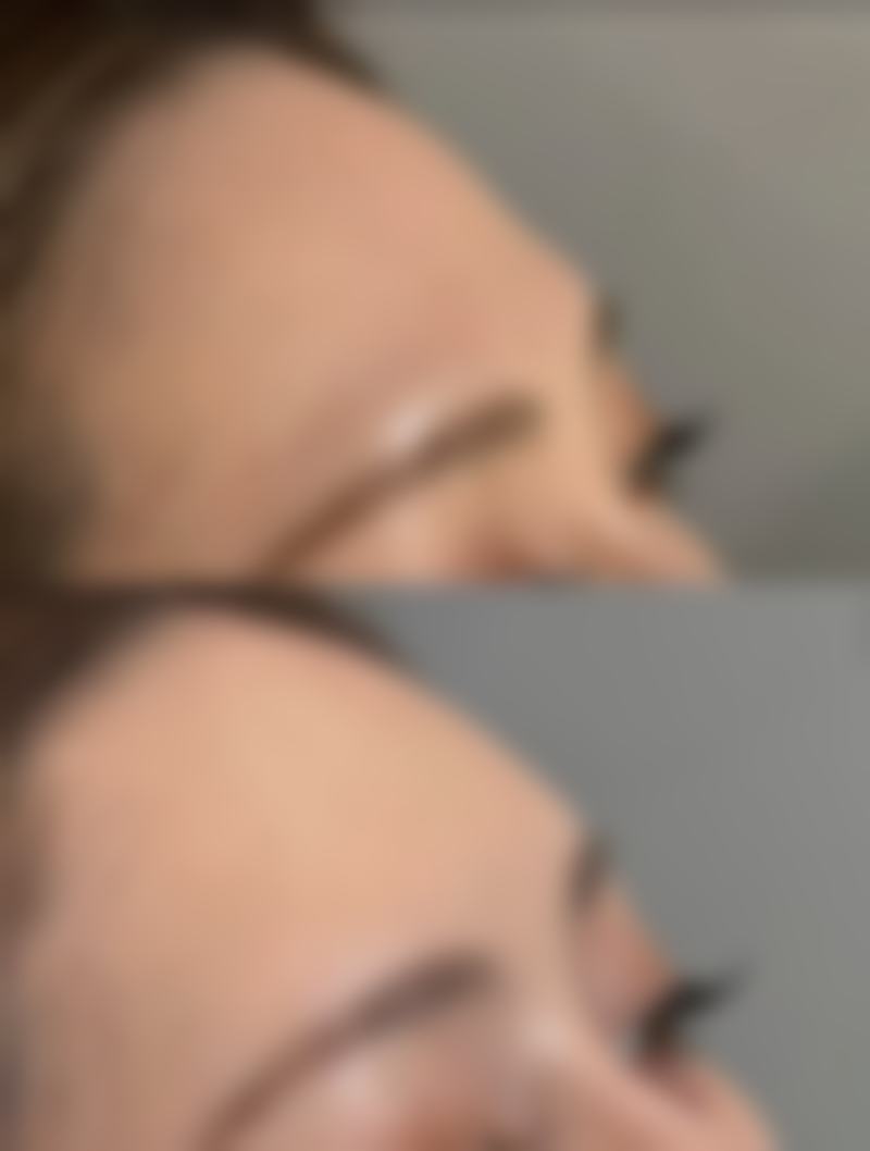 四、缓解仰卧不适的方法