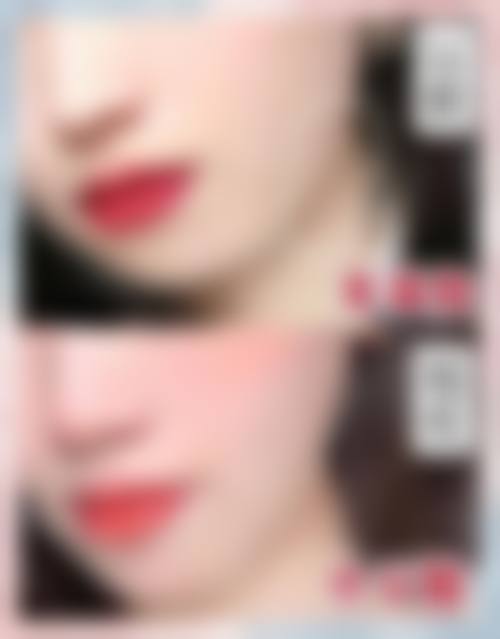 三、榆林亿安医院医学美容整形科诊疗项目有哪些?