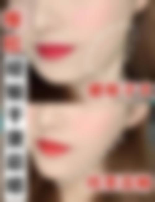 八、济南时逅整形医院真实的患者评价