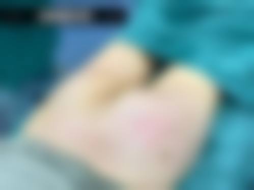 二、韩国4ever皮肤科(釜山西面店)怎么样?