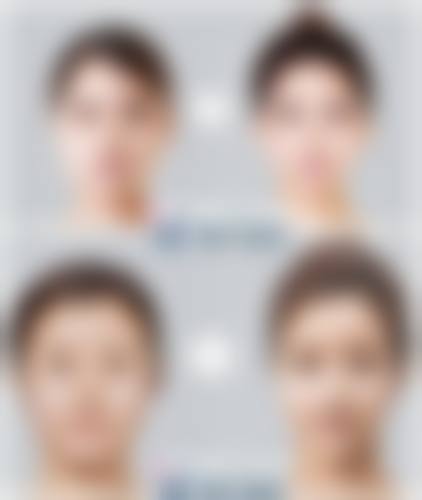 四、唐山瑞倪维儿健康美容医院整形科特色项目