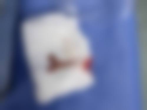 八、Milla医院真实的患者评价