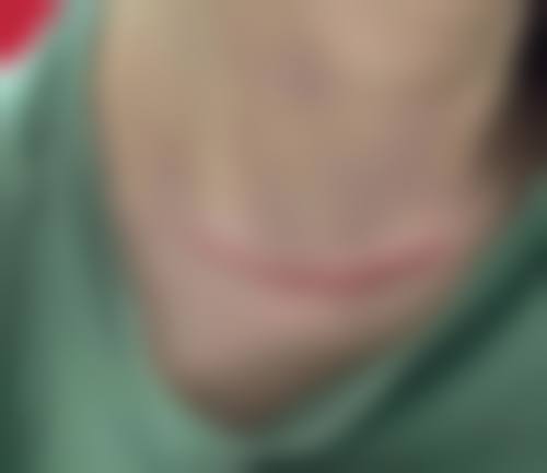 二、开封市第一人民医院烧伤整形外科怎么样?