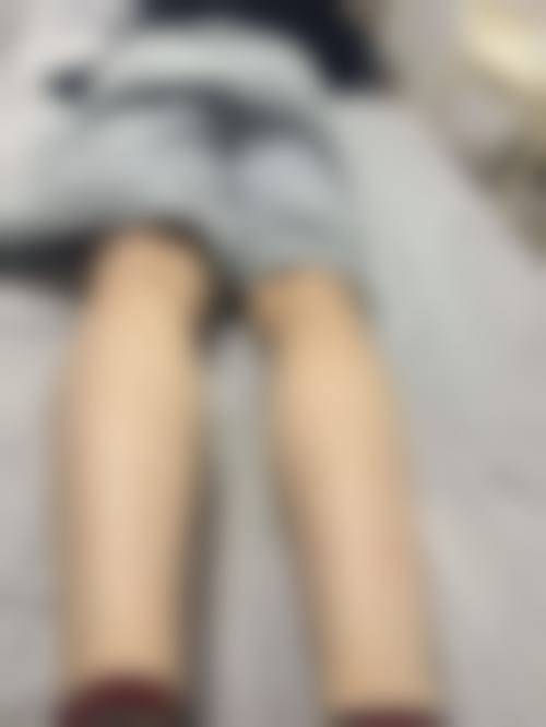 四、嘉兴市第二医院(皮肤医疗美容科)特色项目