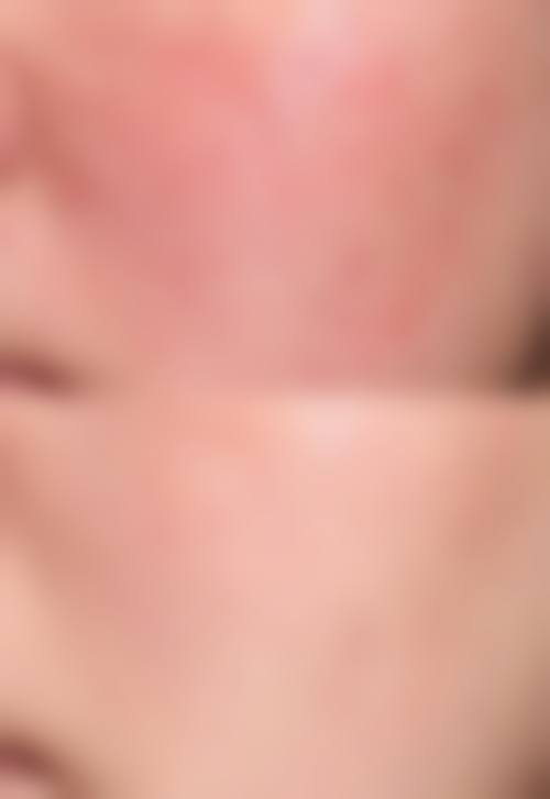 七、嘉兴市第二医院(皮肤医疗美容科)预约方式