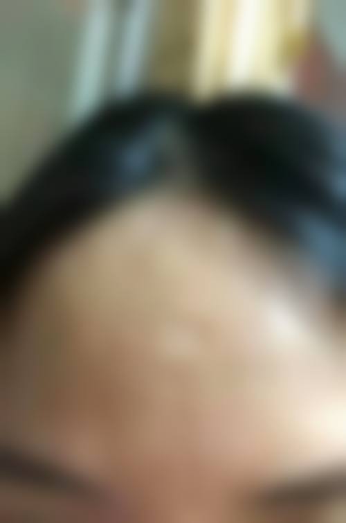 八、运城光子医疗美容预约方式