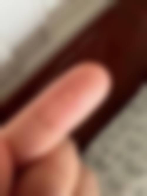 四、深圳蓓焱医疗美容诊所特色项目