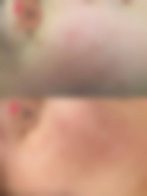 二、嘉兴市第二医院(皮肤医疗美容科)怎么样?