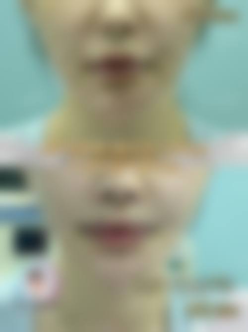 二、聊城青悦整形医院怎么样？