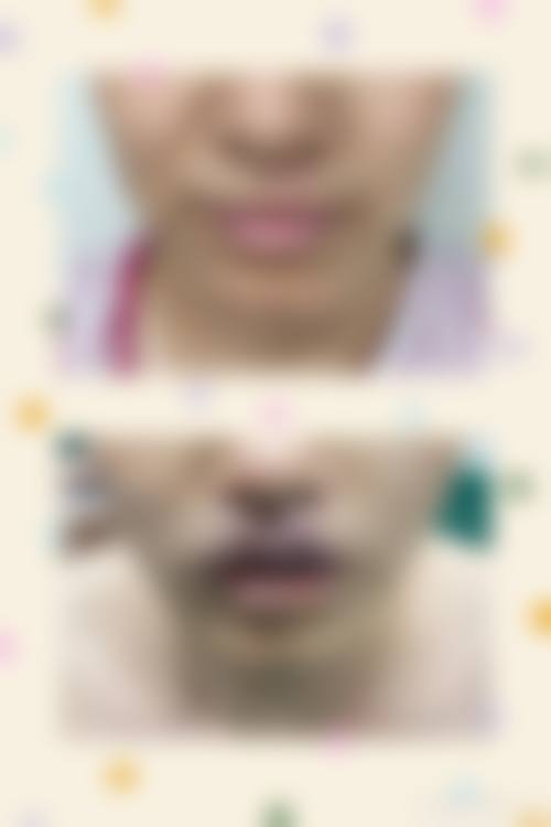 五、深圳蓓焱医疗美容诊所价格表