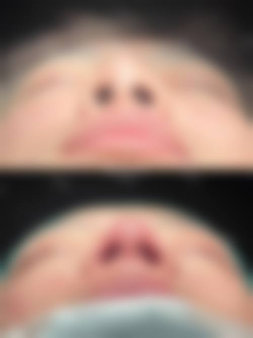 九、韩国4ever皮肤科(釜山西面店)真实的患者评价