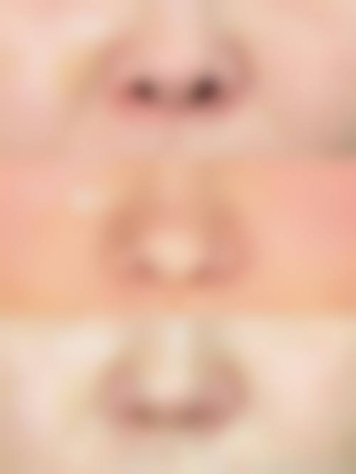 八、聊城青悦整形医院真实的患者评价