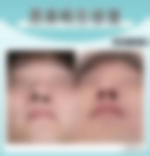 五、北京武警总医院医学美容整形中 心价格表