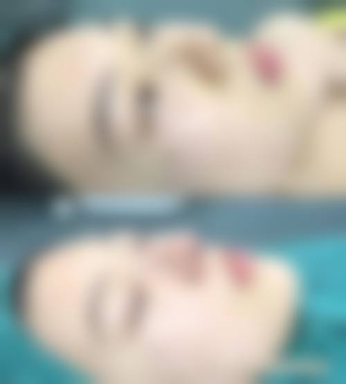 八、国内人民解放军第二0二医院美容整形中 心真实的患者评价